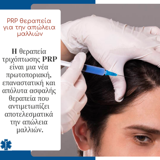 PRP θεραπεία για την απώλεια μαλλιών